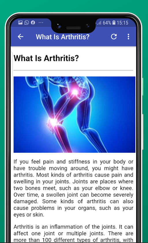 a jobb térdízület deformáló arthrosisa ízületek típusú ízületi sérülések
